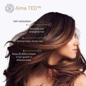 15% Off of a Package of 5 Alma TED Treatments