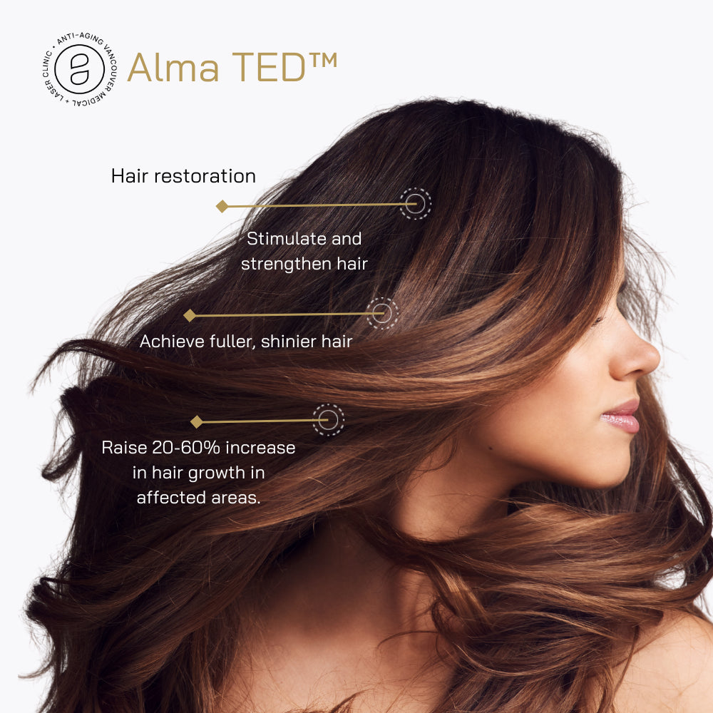 10% Off of a Package of 4 Alma TED Treatments